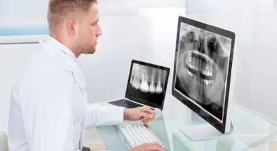 Dental Implants in Costa Rica – treatments, considerations & benefits